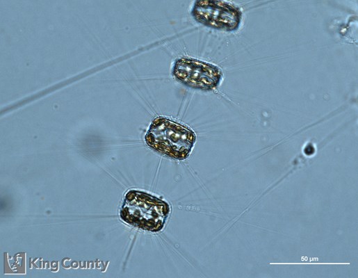 Photo of Thalassiosira pacifica/Thalassiosira aestivalis